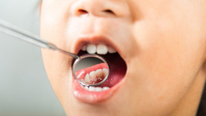 5 dicas para cuidar da saúde bucal na infância